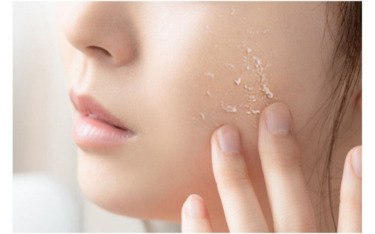 Manyo Galactomy Peeling Gel 75 мл — Ензимна пілінг-скатка з галактомісісом
