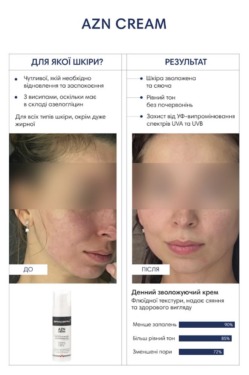 Braderm Azn Cream 30 мл — Денний крем з ніацинамідом