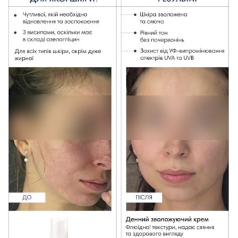 Braderm Azn Cream 30 мл