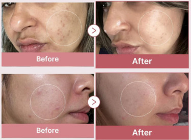 Medicube PDRN Pink Peptide Serum — Восстановительная сыворотка с полинуклеотидами и пептидами