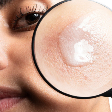Allies of Skin Azelaic & Kojic Advanced Clarifying Serum — Освітлююча сироватка з азелаїновою кислотою