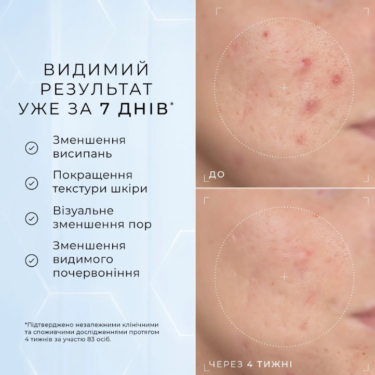 Medik8 Niacinamide Peptides — Cироватка з 10% ніацинамідом та пептидами